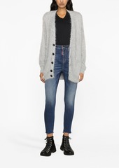 Dsquared2 cropped skinny jeans