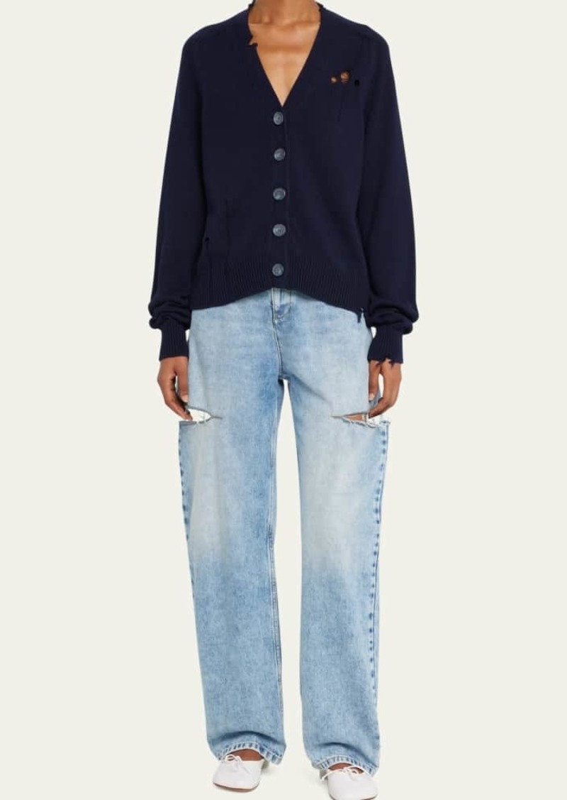 Maison Margiela Distressed Button-Down Cardigan